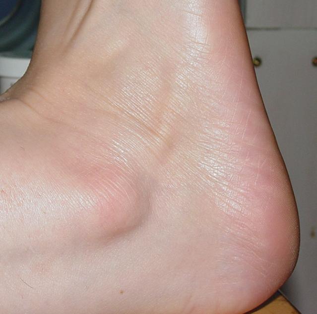 ankle