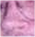 nose