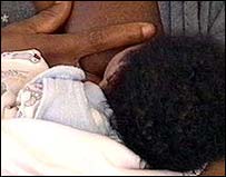Breastfeeding